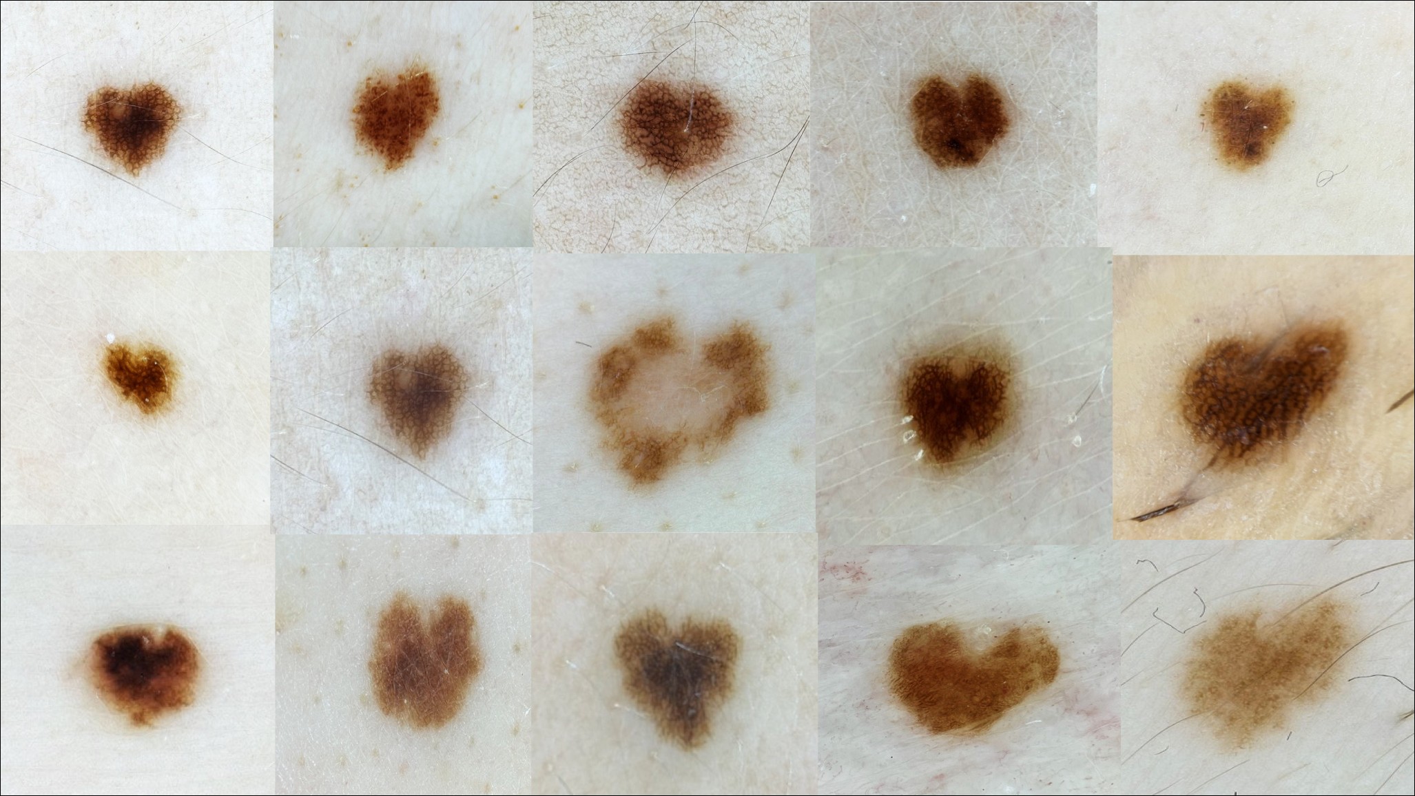 Südame Sünnimärgid